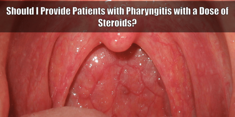 Clinical Conundrums: Should I Provide Patients with Pharyngitis a Dose of Corticosteroids